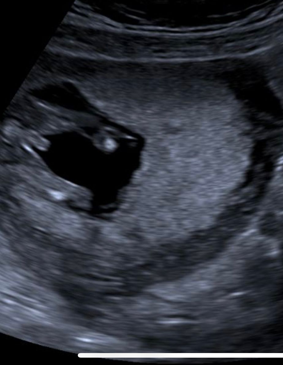 Potty shot geslachtsbepaling echo